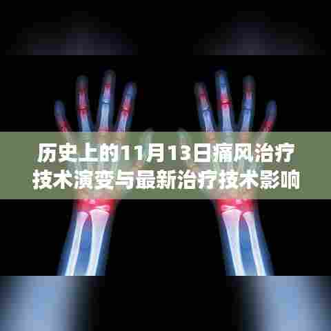 历史上的11月13日痛风治疗技术演变与最新治疗技术影响概览