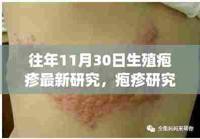 揭秘生殖疱疹新进展，疱疹研究新突破与往年最新研究成果发布